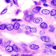 Image for article titled The fine line between replicating cells and cancer, explained
